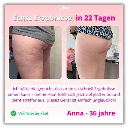 Infinity™ - CelluLift Pro