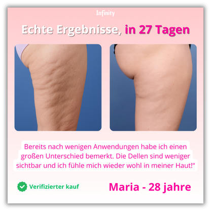 Infinity™ - CelluLift Pro